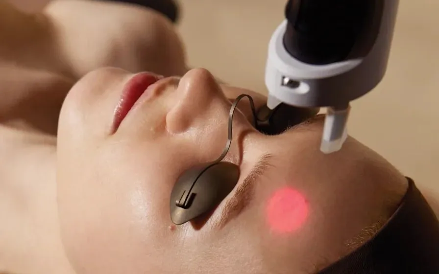 A patient wearing eye shields during a laser facial
